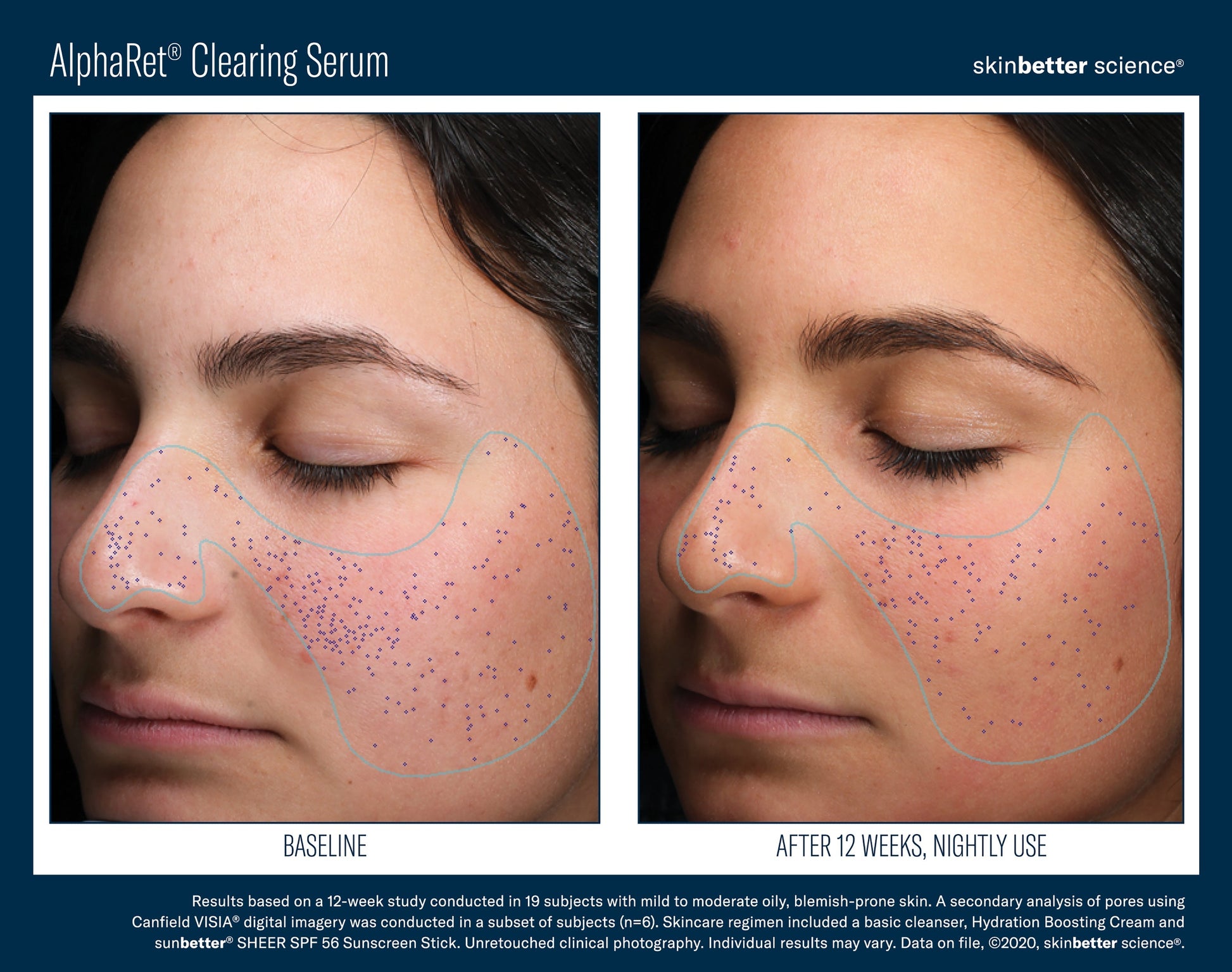 AlphaRet Clearing Serum 50 ml