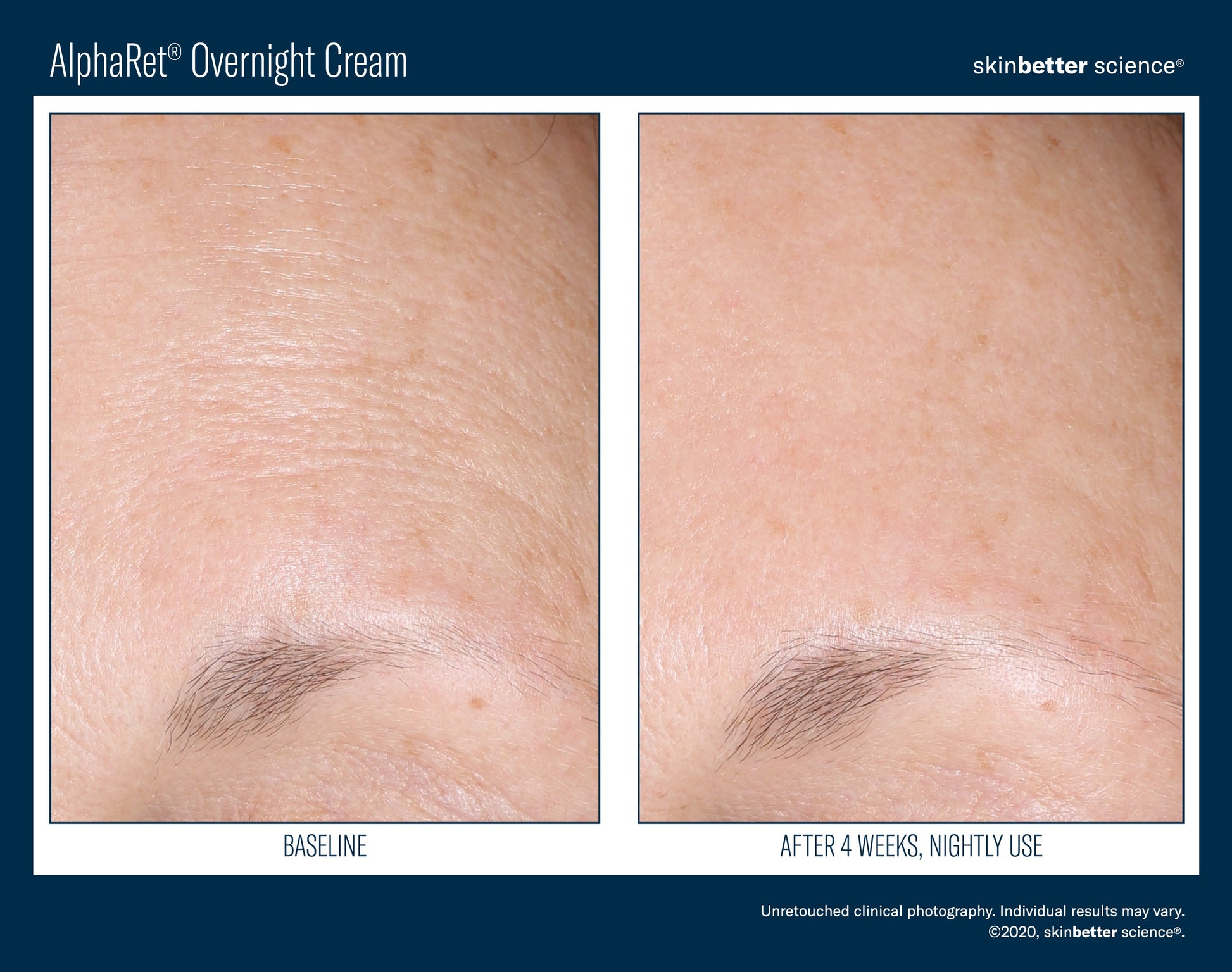 AlphaRet Overnight Cream 30 ml