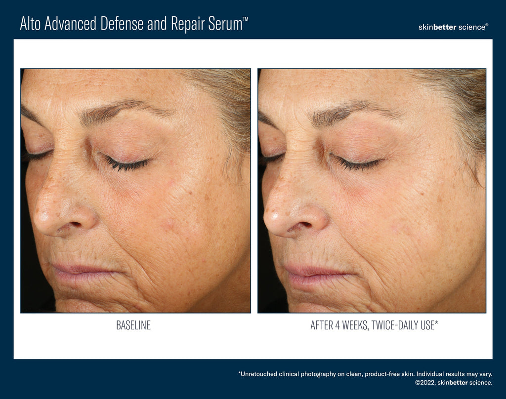 Alto Advanced Defense and Repair Serum 30 ml