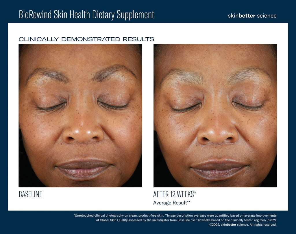 BioRewind Skin Health Dietary Supplement