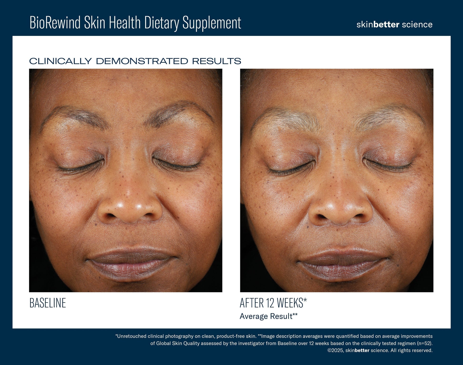 BioRewind Skin Health Dietary Supplement