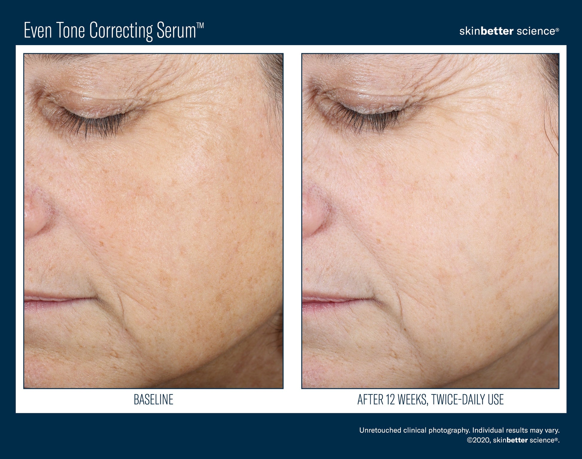 Even Tone Correcting Serum 50 ml