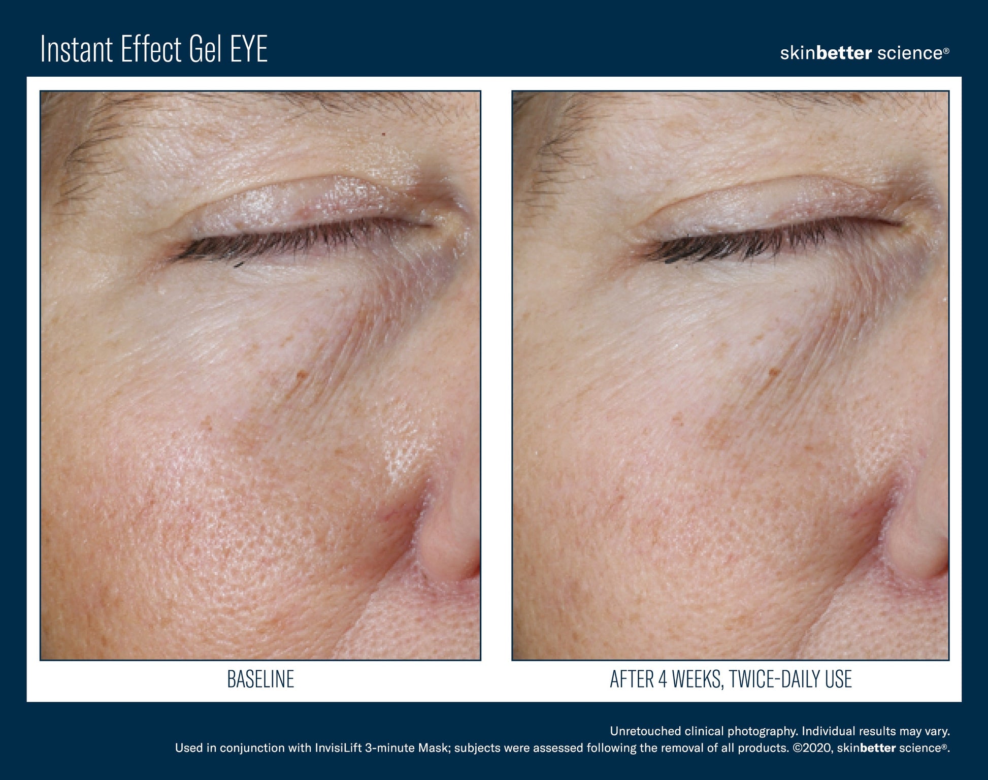 Instant Effect Gel EYE