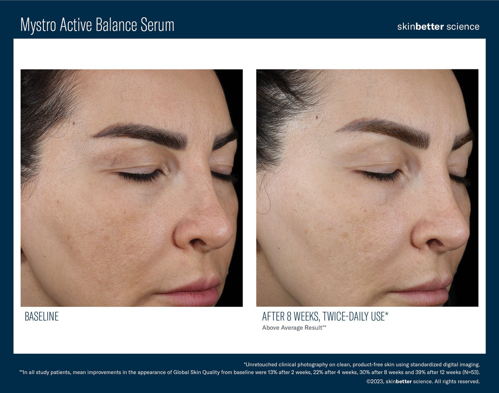 Mystro Active Balance Serum 50 ml