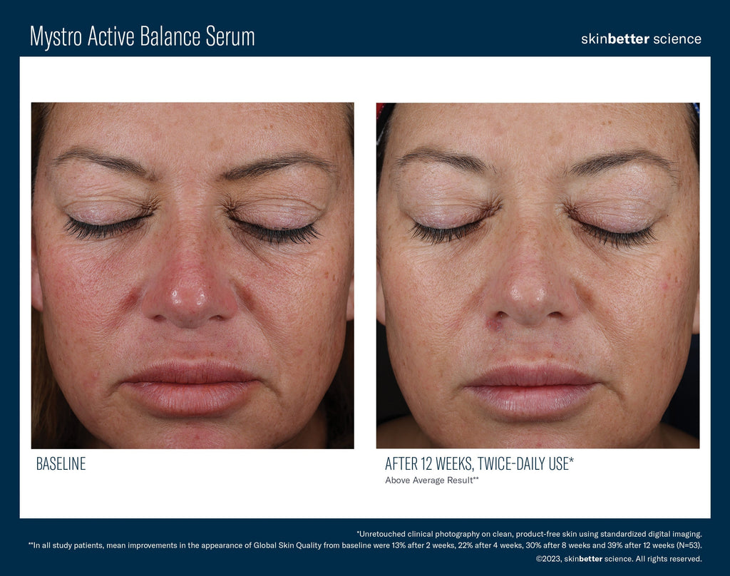 Mystro Active Balance Serum 50 ml