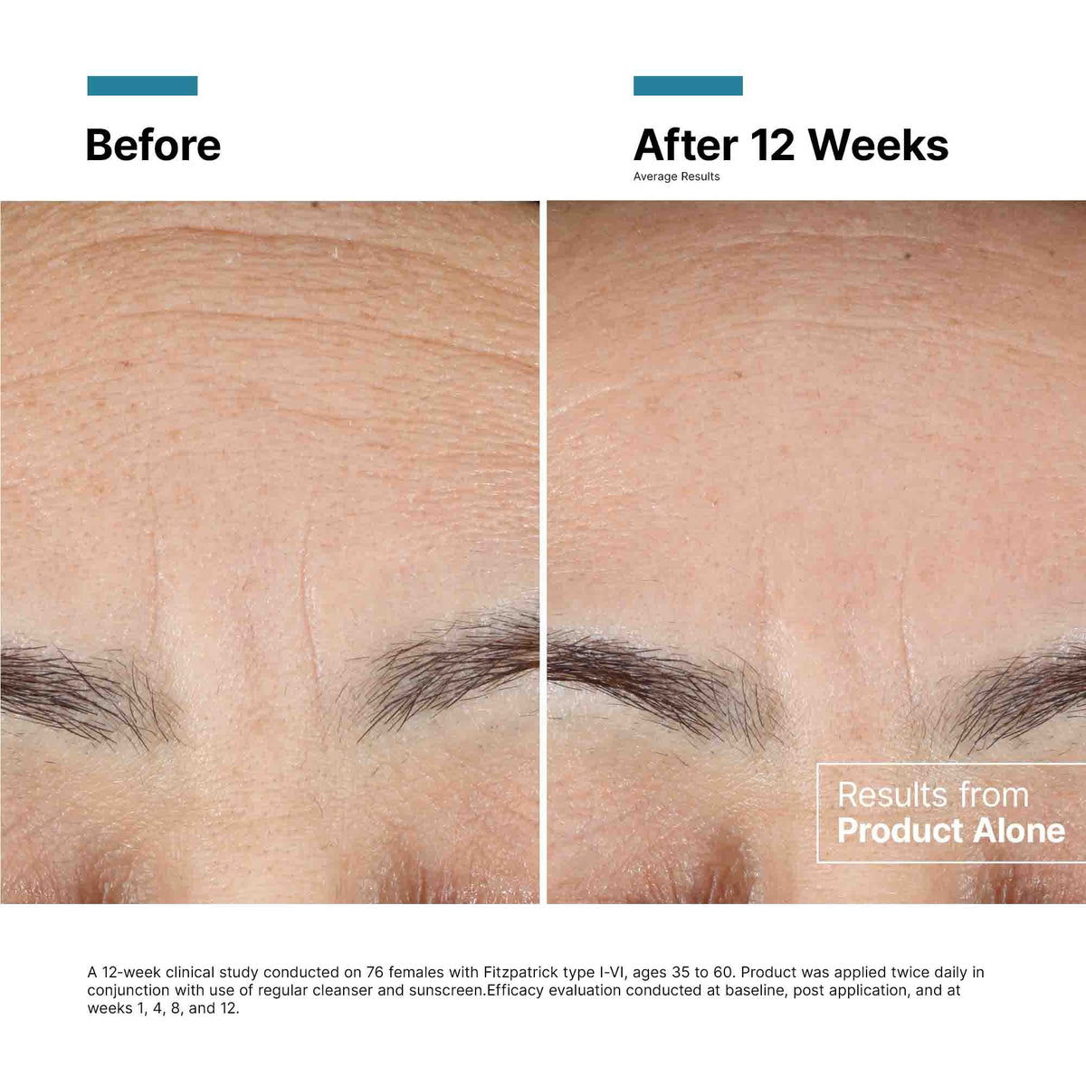 Advanced RGN-6 Skin Regeneration Cream 1.7 oz