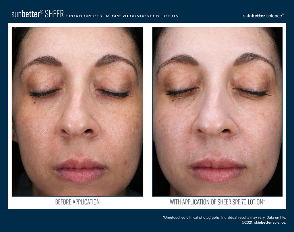 SunBetter SHEER SPF 70 Sunscreen Lotion