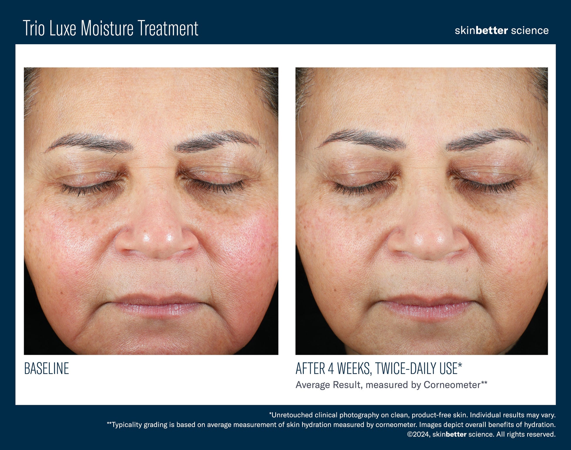 Trio Luxe Moisture Treatment 50 ml