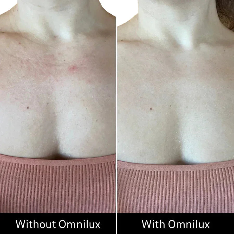 Omnilux Contour Neck & Decollete