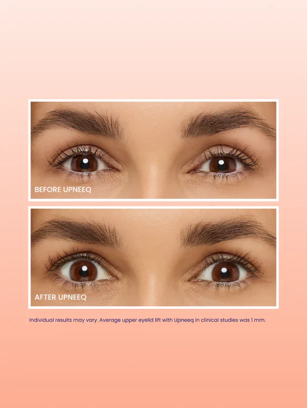 UPNEEQ Eye Drops 30 ct